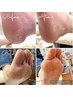 【ガサガサかかと・硬くなった角質に】足裏角質ケア