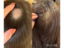 ランポ(lampo)の雰囲気（《スカルプ幹細胞Lit》頭皮のお悩みにもアプローチ！◯Lit 1回目）