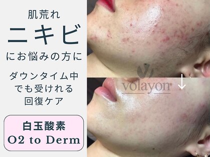 スワン 大阪南堀江(swan)の写真