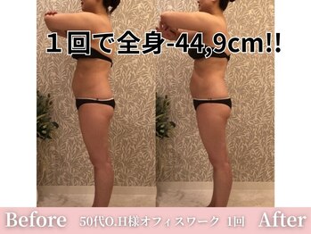 アメリイ 百合ヶ丘 新百合ヶ丘(Amerii)/【痩身】1回全身-44.9センチ痩せ