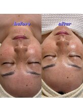 リボーン(be reborn)/ツヤ肌