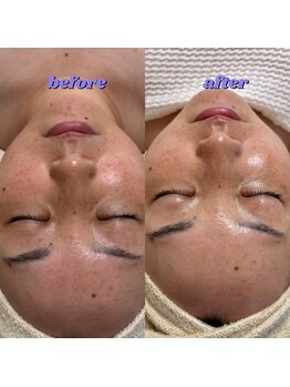 リボーン(be reborn)/ツヤ肌