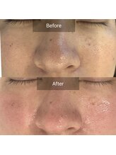 ラリュンヌ(La Lune)/ハーブ2回目のお客様