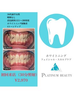 プラチナムビューティ 渋谷店(PLATINUM Beauty)/セルフホワイトニング