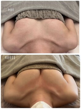 美人バスト 浜松店/◆バストアップ &nbsp;BeforeAfter◆