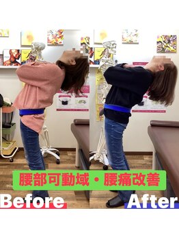 ヒデ整体院(Hide整体院)/猫背矯正骨盤矯正B/A肩こり腰痛