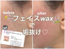 スウィートラッシュ 川口店(Sweet Lash)/フェイスwax