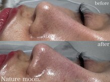ナチュールムーン(Nature moon.)/毛穴洗浄