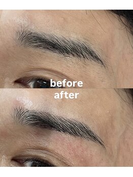 ケープラス(K Plus+)/before→after