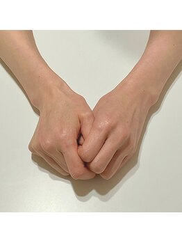 ブラン(blanc)/手を見られるのが苦手…