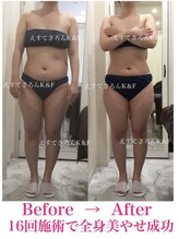 えすてさろん ケイアンドエフ(k&f)/ 施術結果16回