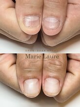 マリーロール 淀屋橋本店(Marie Laure)/自爪育成/深爪矯正/ネイルケア