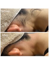 リゲルス(Regel)/うなじワックス脱毛2