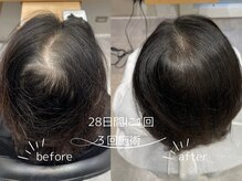 ターントウキョウスパ 表参道(turn TOKYO spa)の雰囲気（生きた植物に溢れた白を基調とした明るい店内です。）