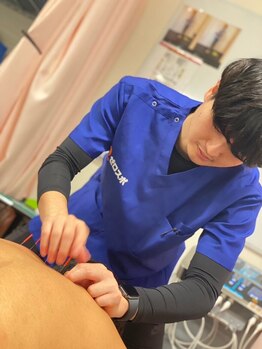 ゼロスポ鍼灸 整骨院 大口通/冷えや長年のコリには鍼灸が◎