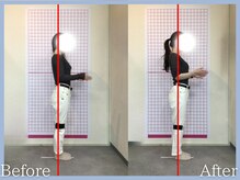 トロ整骨院(toro整骨院)/骨盤矯正★1回の効果★40代女性