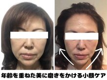 ラクタイセイタイイン 梅田茶屋町店(楽体整体院)/あきらめないアラフィフ小顔矯正