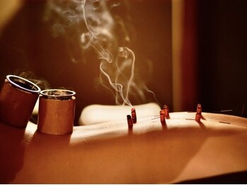 ヤドリ(yadori)の写真/血行促進/代謝UP/しつこい慢性冷えにはお灸が◎東洋医学、体質ケアで温活を超え内側から冷えのない身体へ