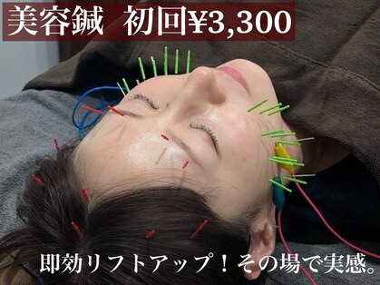 アンブル(Ambre)の写真