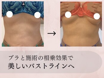 ナニキョウト(nani kyoto)/ビフォーアフター