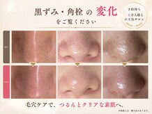 菌活フェイシャル専門店 florasKIN桑名店