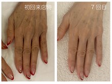 キレイテ 上野店/50代/7回目【ハンドケア稲荷町】