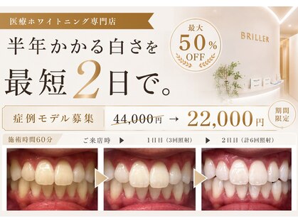 ブリエ(BRILLER)の写真