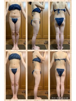 リエル ダイエットアンドビューティー(RIEL diet&beauty)/セル撃退コース 半身