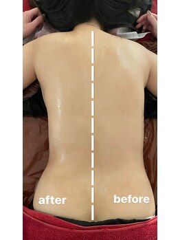 ビューティールーム リヴィア(BEAUTY ROOM RIVIA)/筋膜リリースbefore/after