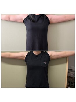 マイティー整骨院 ココア(CoCoa)/痩身マシン