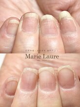 マリーロール 淀屋橋本店(Marie Laure)/自爪育成/深爪矯正/ネイルケア