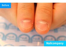 ネイルカンパニー/