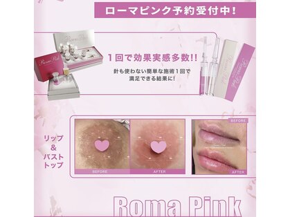 レティティア(Laetitia)の写真