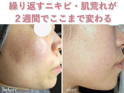 エアル(earu.)の写真