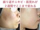 エアル(earu.)の写真