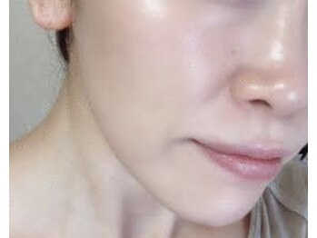 ミント/リフトアップ、引き上げ、栄養◎