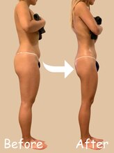 ベルペール(Belle perle)&nbsp;インド エステ