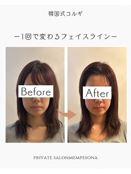 ムンプソナ(Mempesona)/ビフォーアフター