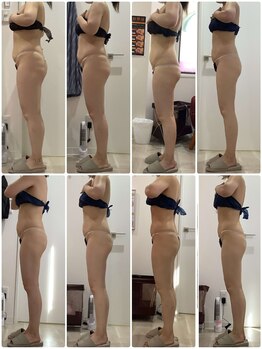 プラチナアース 守谷店(Platinum earth)/痩身ビフォーアフター