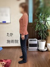 たか施術院/首こり 背中の痛み 20代 学生