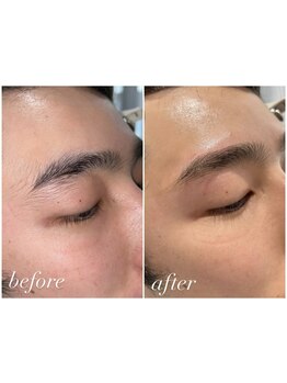 メンズフェイシャル