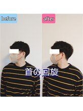 エンビジョン(ENVISION)/before→after
