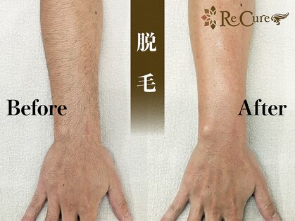 リキュア(ReCure)の写真