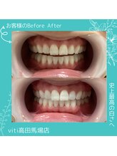 ヴィティ 高田馬場店(viti)/ビフォーアフター【高田馬場】