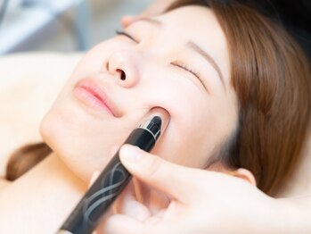 エステ ド マシェリ―の写真/【マシェリ―人気NO1★】全体的に下がったたるみを改善◎施術後の変化に感動♪若々しい印象に！