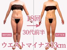 べモーレ 上本町 谷町九丁目(Bemolle)/30代痩身18回ビフォーアフター☆