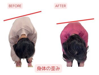 浜町しあわせ整体院/大きな背骨の歪み