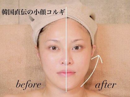 トータルビューティーサロン レビュー(REVIEW)の写真