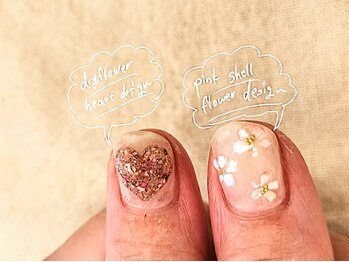 アンテテネイル(ANTETENAIL)/