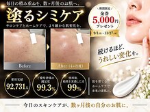 テセラ(Tethere)